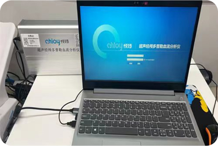 超声经颅多普勒血流分析仪